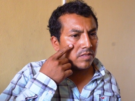 ingeniero agredido.vidal.escudero